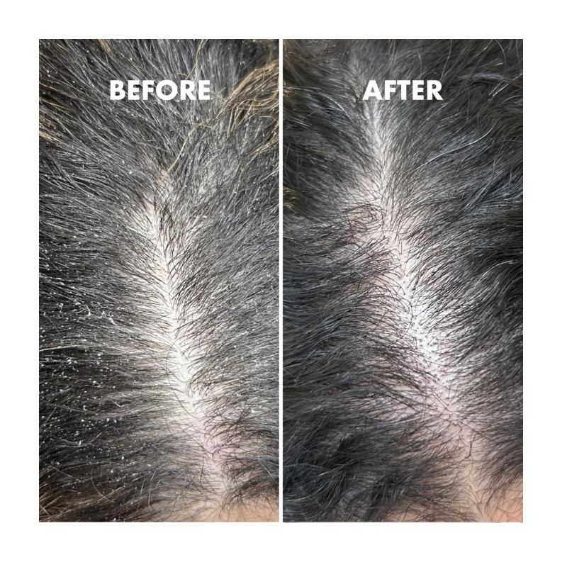 Hydration Drops, 50ml 3